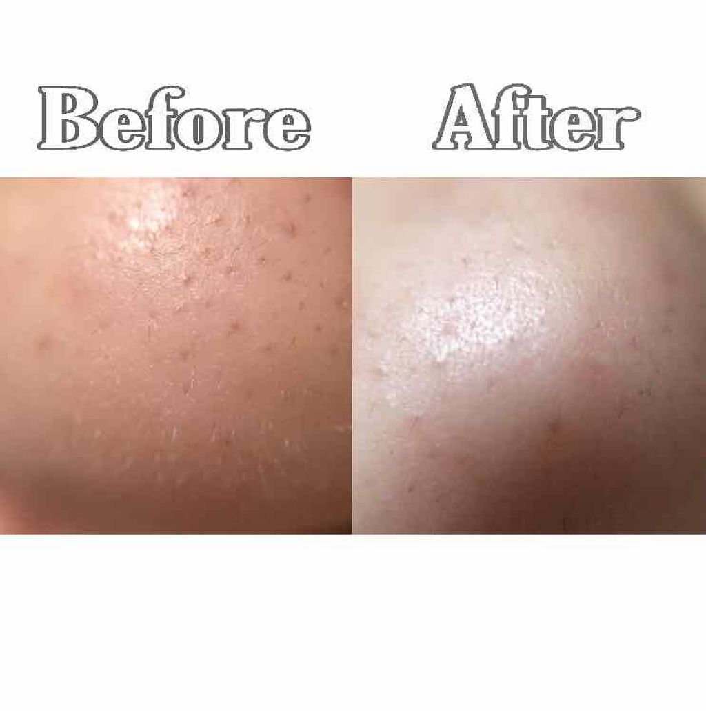 潤浸保湿 フェイスクリーム/キュレル/フェイスクリームを使ったクチコミ（3枚目）