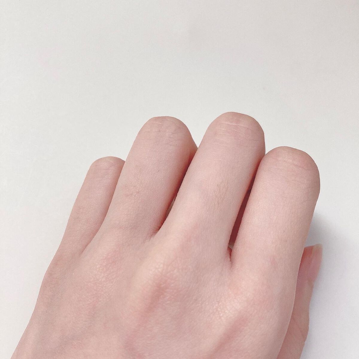 クレブラック リムーバー/グロリアス製薬/その他を使ったクチコミ（3枚目）