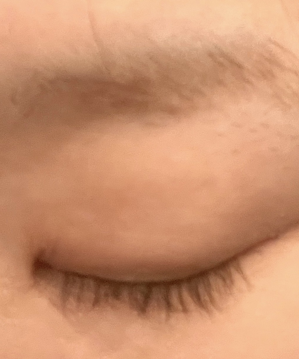 脱色クリーム スピーディー/エピラット/ムダ毛ケアを使ったクチコミ（3枚目）