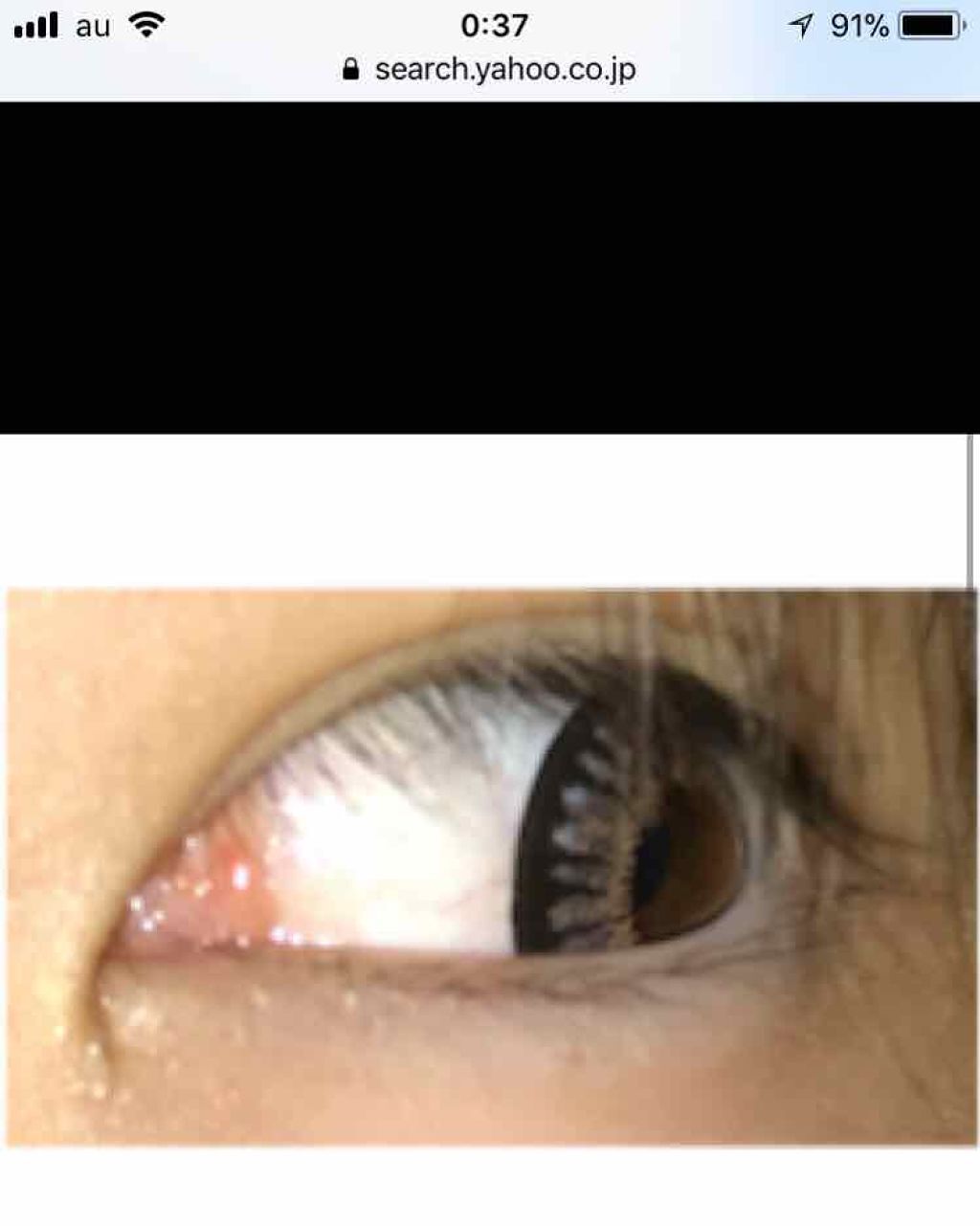 Angelcolor Bambi Series 1day /AngelColor/ワンデー(1DAY)カラコンを使ったクチコミ(2枚目)