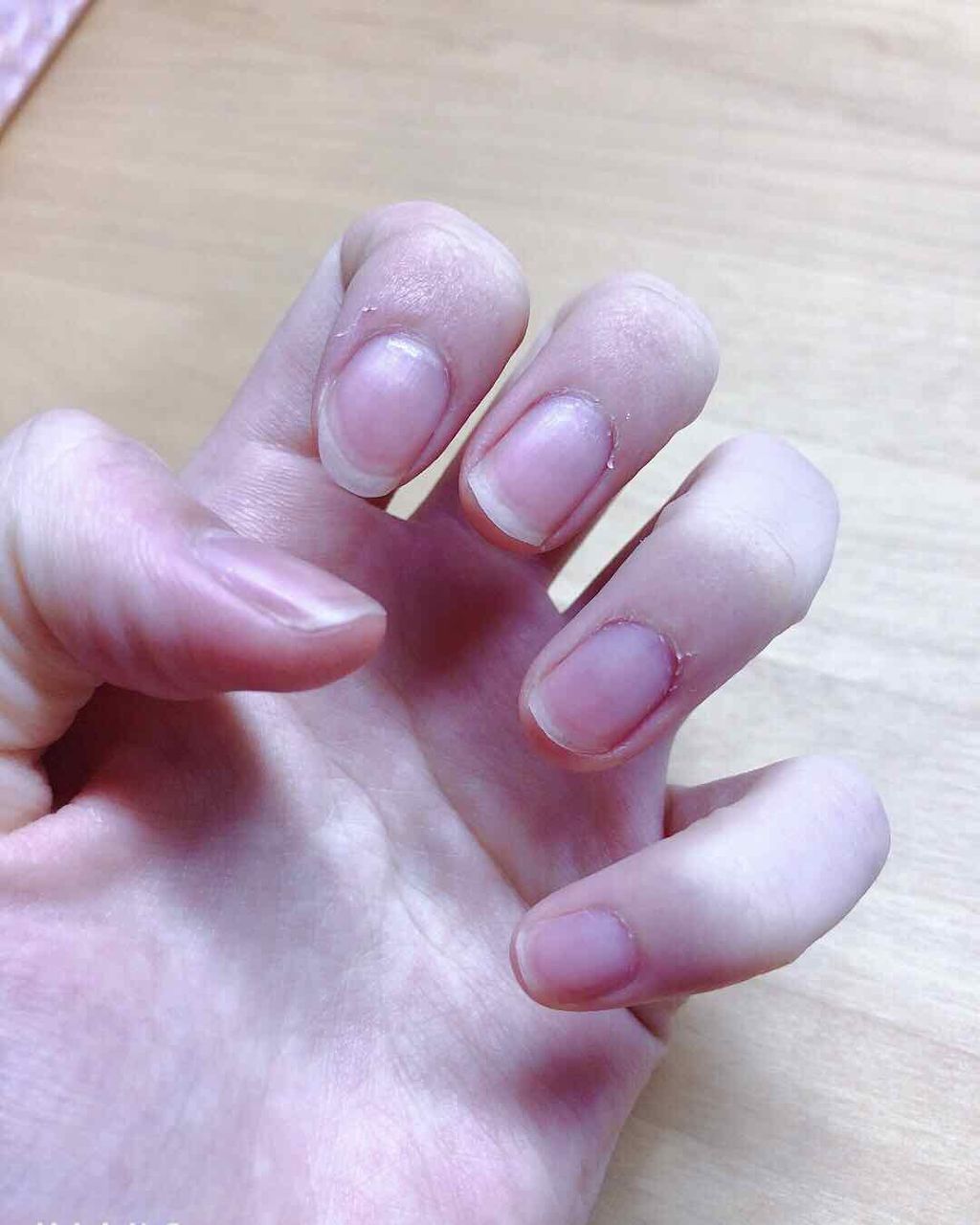 キューティクルトリートメントオイル/DHC/ネイルオイル・トリートメントを使ったクチコミ(2枚目)