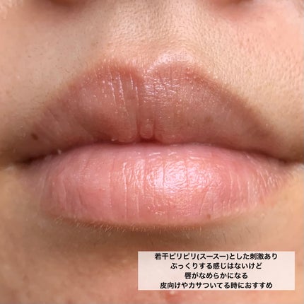 Lip Medex/Blistex/リップバームを使ったクチコミ(6枚目)