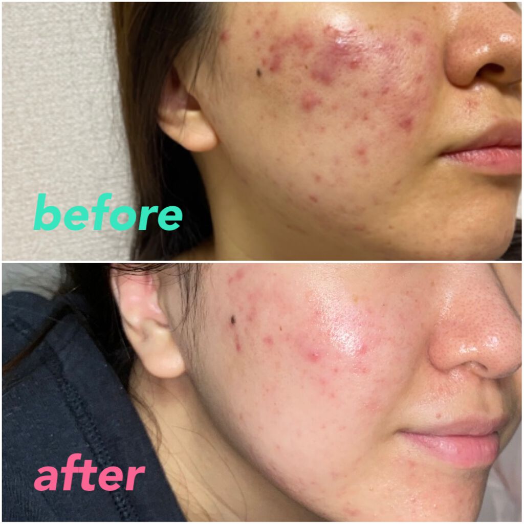 を使ったクチコミ（2枚目）