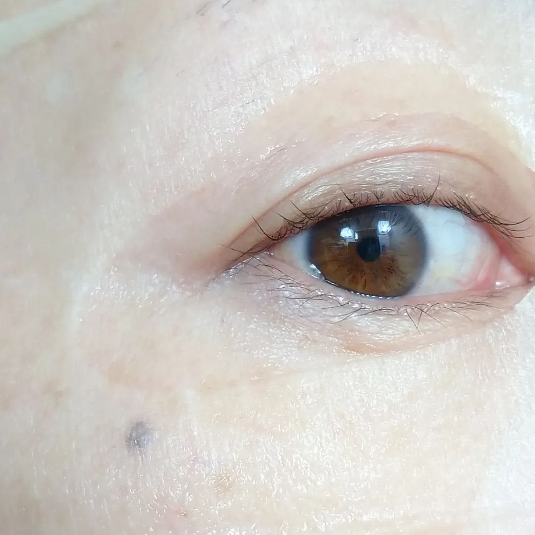 シカアルブチンマスク/NOWATER/シートマスク・パックを使ったクチコミ(9枚目)