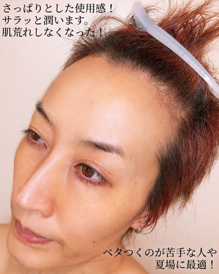 ティーツリーケア ソリューション エッセンシャルマスクEX/MEDIHEAL/シートマスク・パックを使ったクチコミ(5枚目)