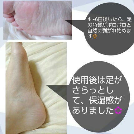 クレンズフットパック/ラブエデリス/レッグ・フットケアを使ったクチコミ(6枚目)