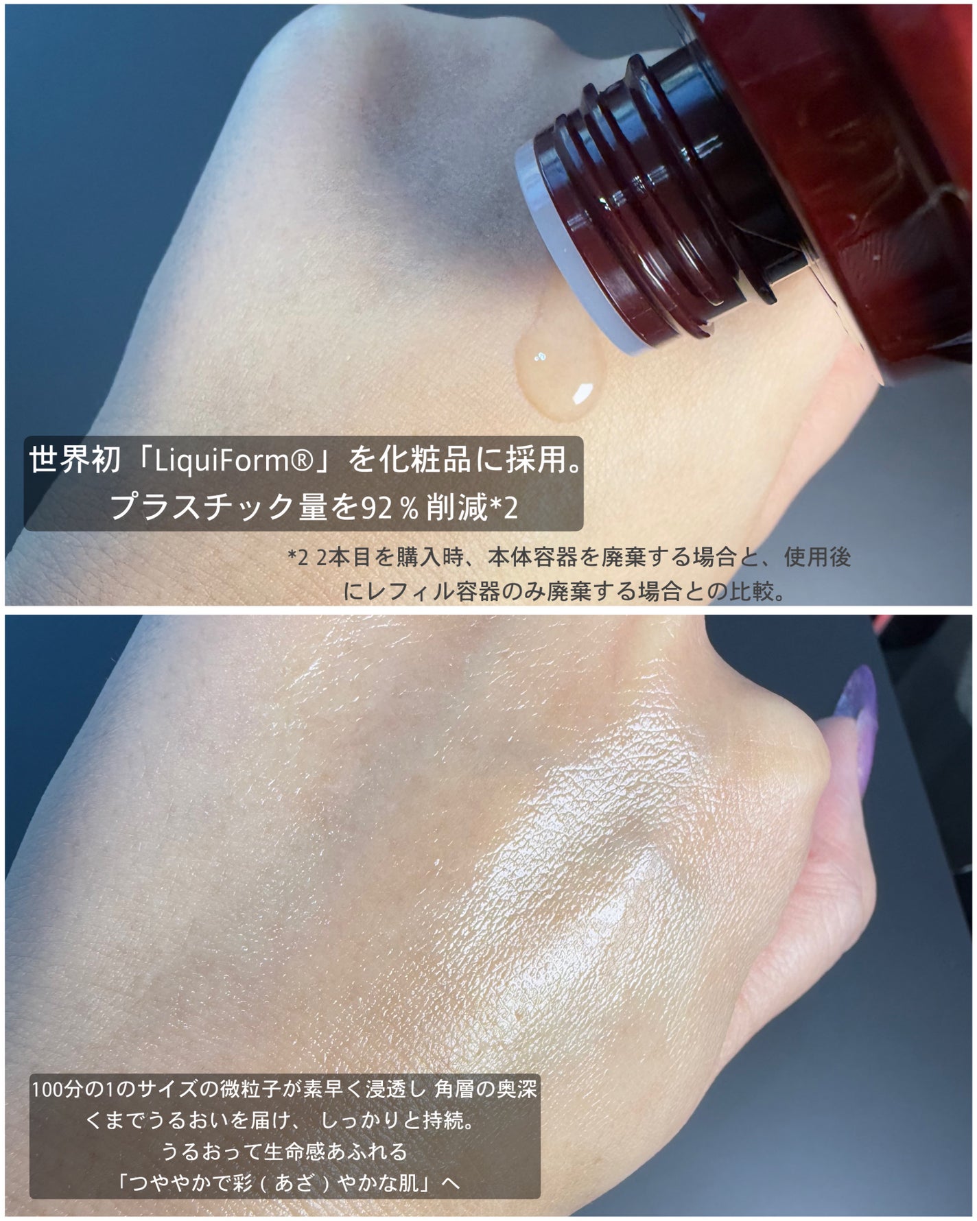 オイデルミン エッセンスローション/SHISEIDO/化粧水を使ったクチコミ(2枚目)