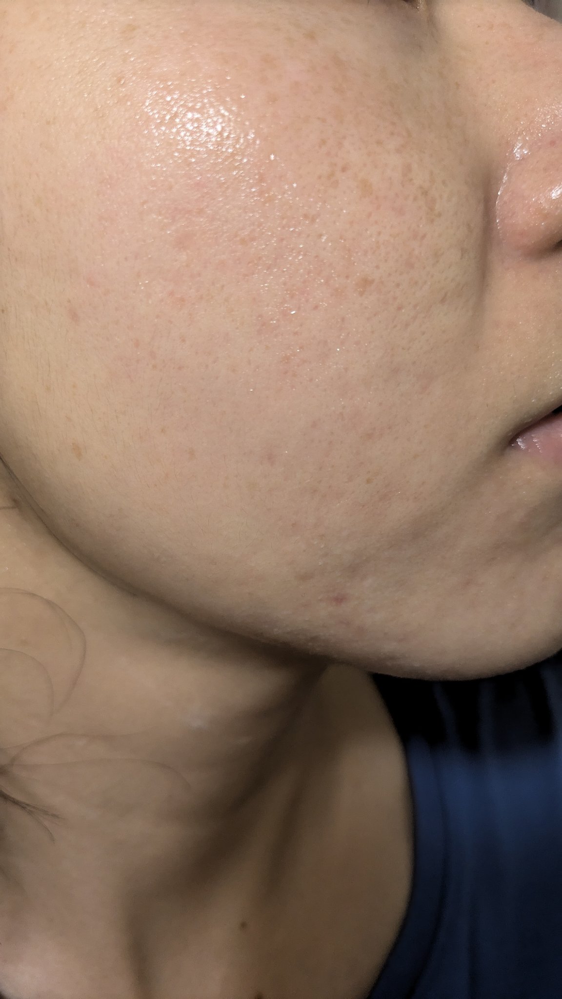 クリーム NC/なめらか本舗/フェイスクリームを使ったクチコミ（1枚目）