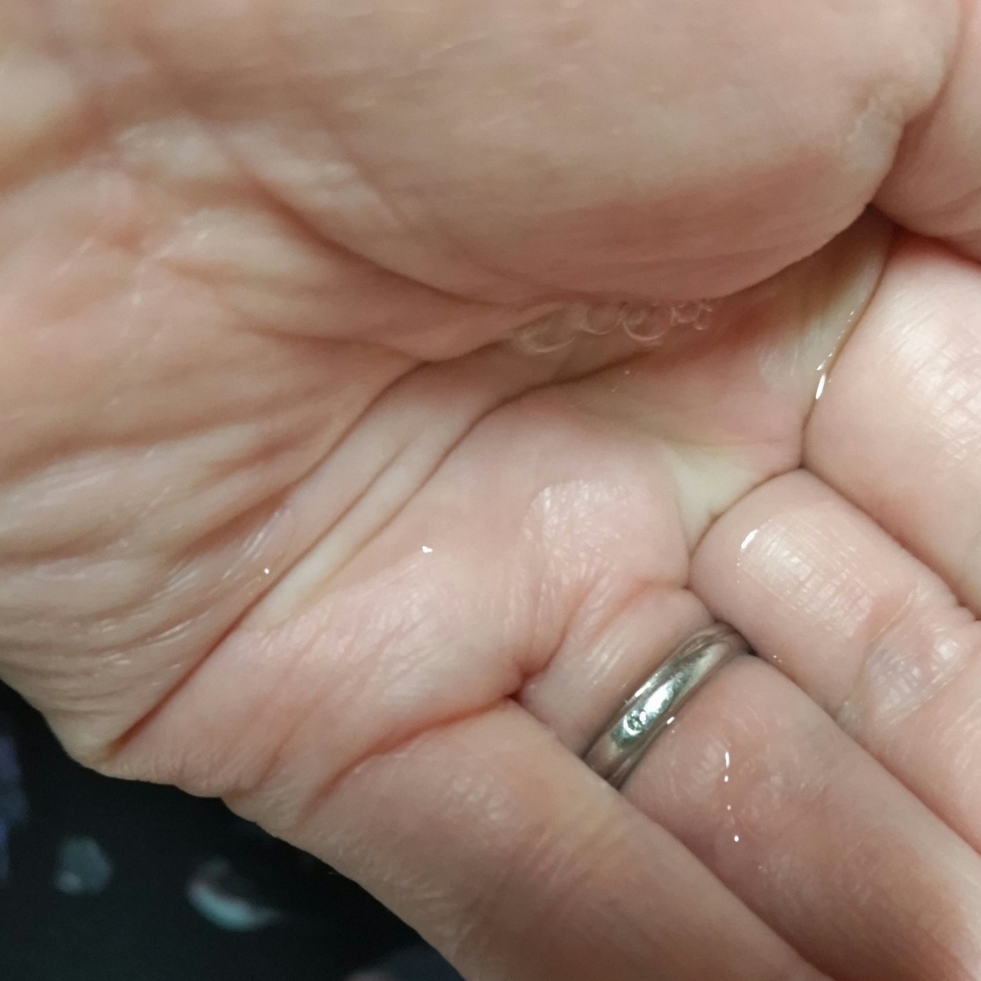 トリートメントソフナー エンリッチド/SHISEIDO/化粧水を使ったクチコミ(2枚目)