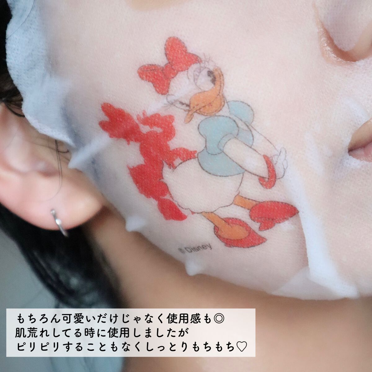 フォトピックモイスチャー パンテケア マスク/JMsolution-japan edition-/シートマスク・パックを使ったクチコミ(4枚目)