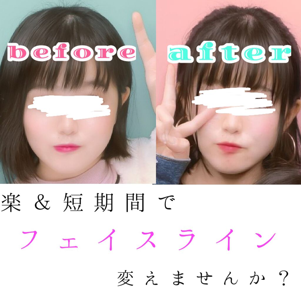 フェイスローラー/セリア/その他スキンケアグッズを使ったクチコミ(1枚目)