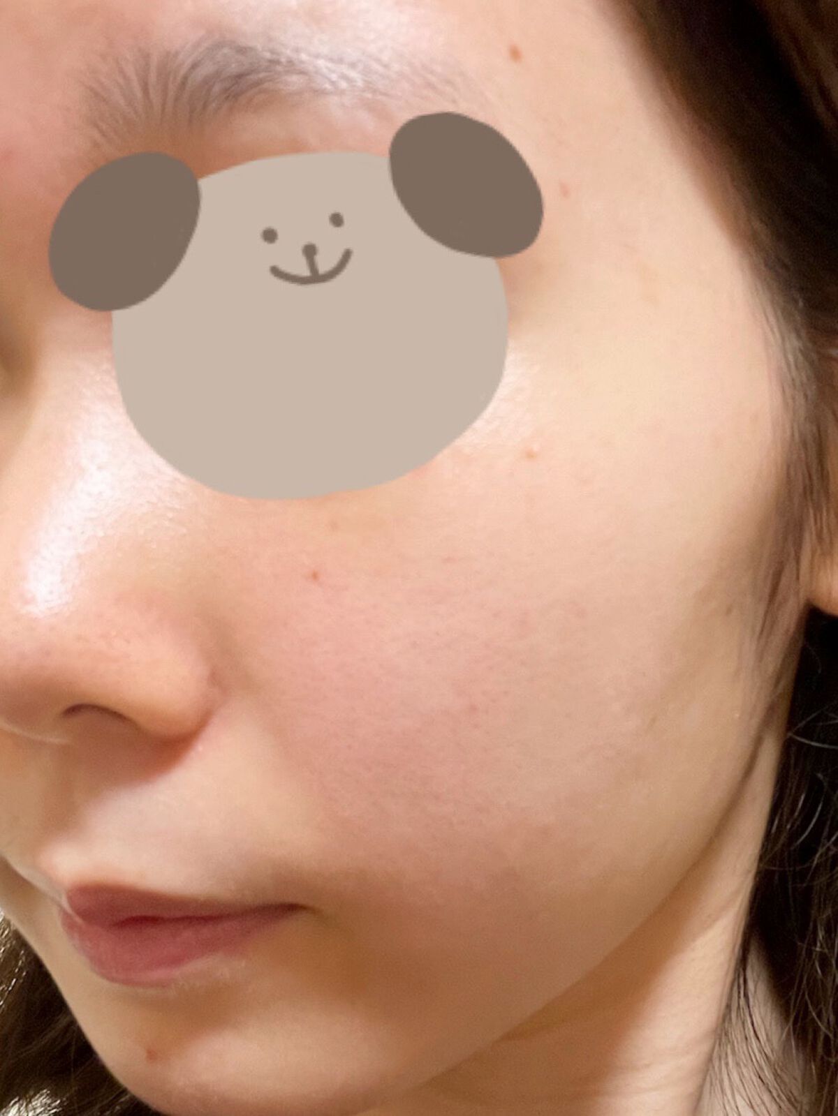 オードムーゲ 薬用ローション(ふきとり化粧水)/オードムーゲ/拭き取り化粧水を使ったクチコミ(2枚目)