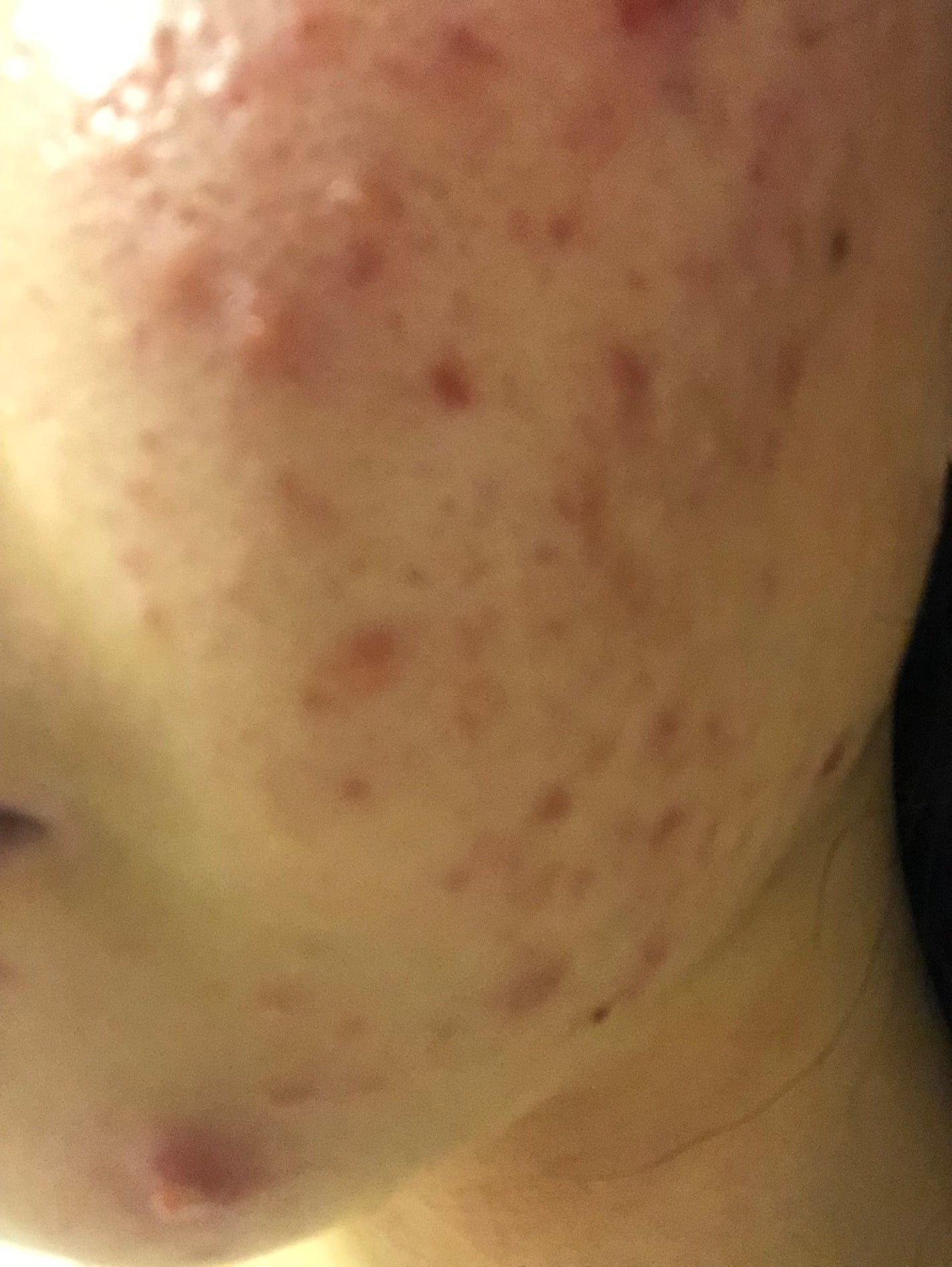 ハトムギ化粧水(ナチュリエ スキンコンディショナー R )/ナチュリエ/化粧水を使ったクチコミ(3枚目)