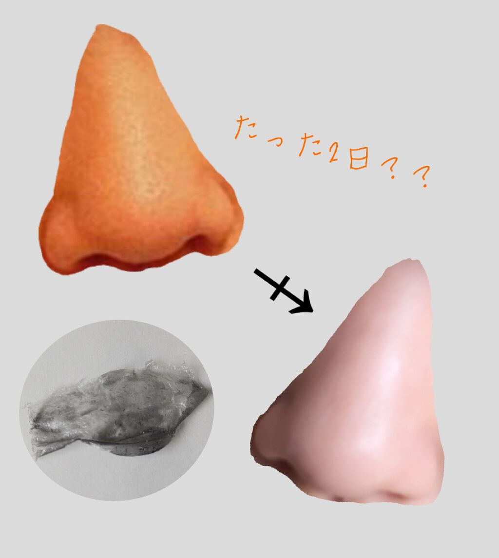 炭・鼻の毛穴ジェルパック/DAISO/シートマスク・パックを使ったクチコミ（1枚目）