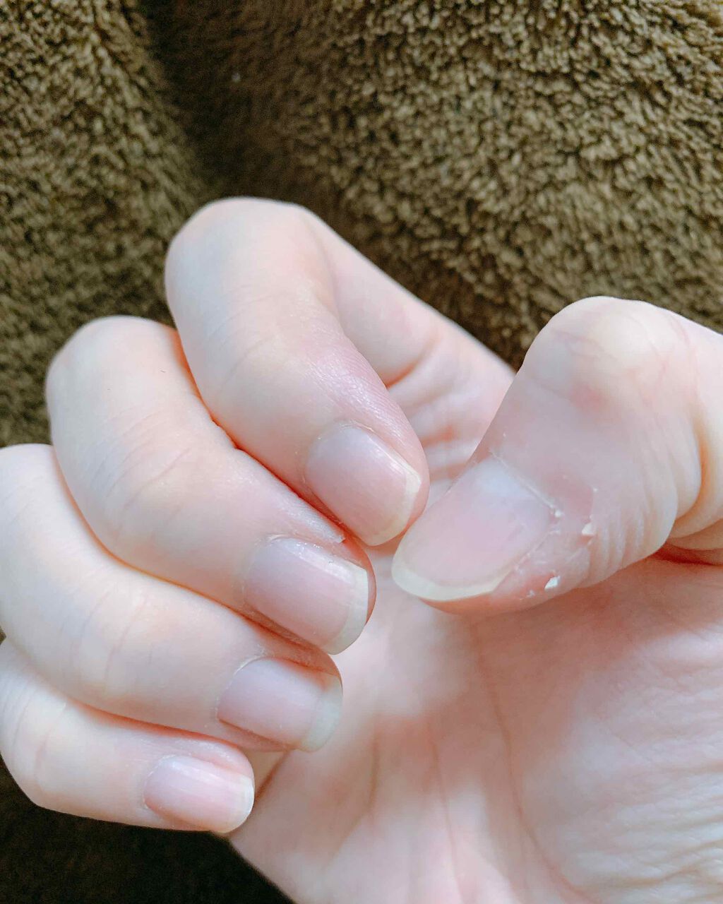 エテュセ クイックケアコート/ettusais/ネイルオイル・トリートメントを使ったクチコミ（2枚目）