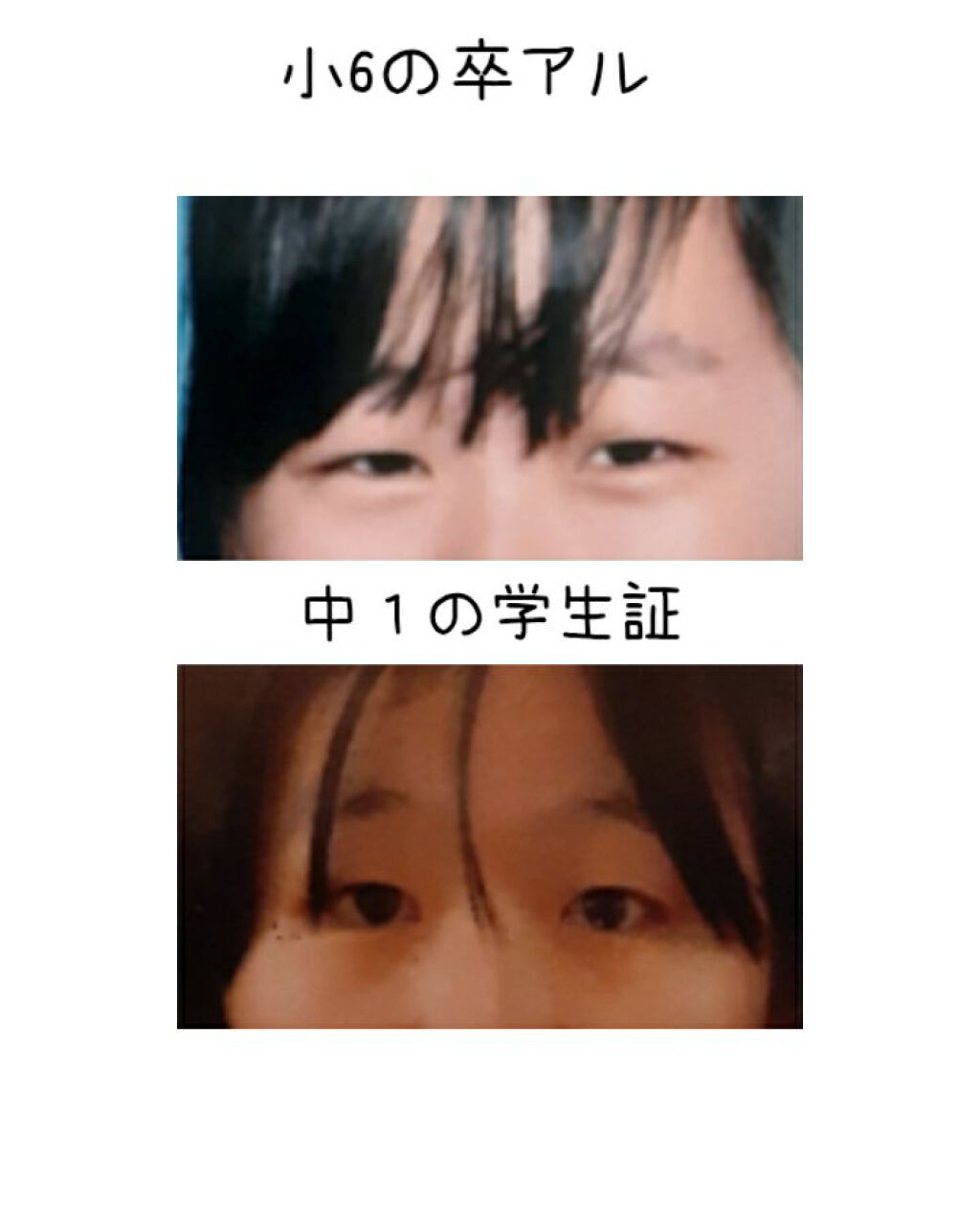 オリシキ アイリッドスキンフィルム		/D-UP/二重まぶた用アイテムを使ったクチコミ（3枚目）