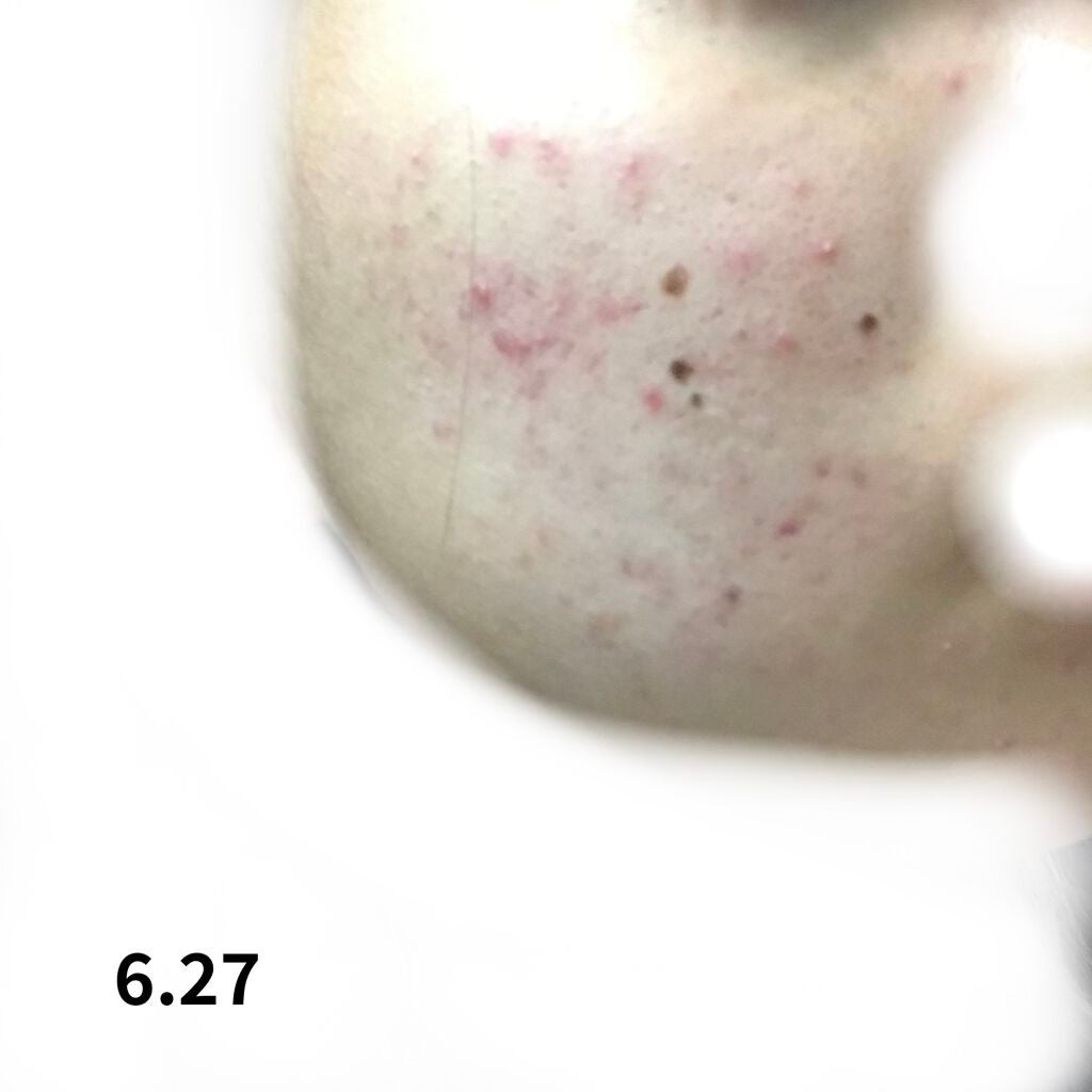 デュオ ザ クレンジングバーム クリア/DUO/クレンジングバームを使ったクチコミ(3枚目)