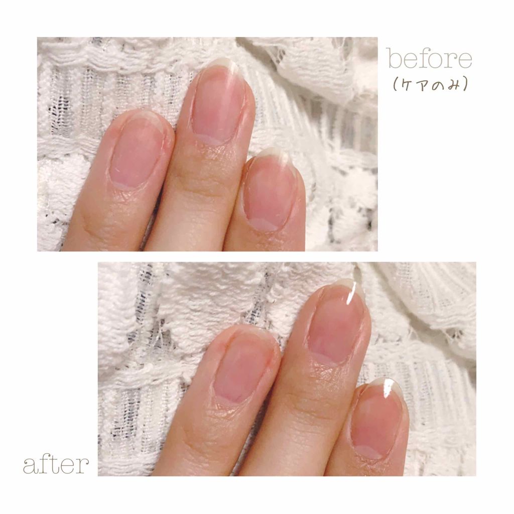 ネイルエンビー/O・P・I/ネイルオイル・トリートメントを使ったクチコミ(3枚目)