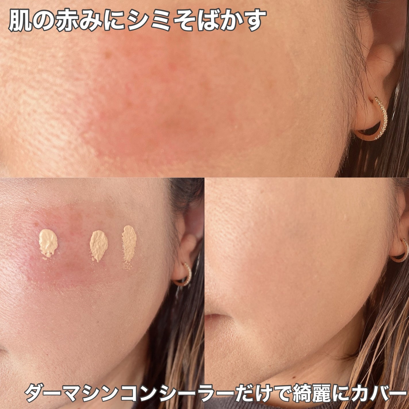 ダーマシンコンシーラー/23years old/リキッドコンシーラーを使ったクチコミ(5枚目)