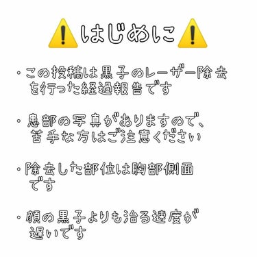 敏感肌な研究者💊あすか💊 on LIPS 「#ホクロをレーザーで除去したお話の経過報告です⚠️患部の写真が..」（2枚目）