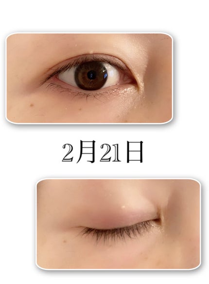 Seracell eyelash glow/Seracell/まつげ美容液を使ったクチコミ(3枚目)