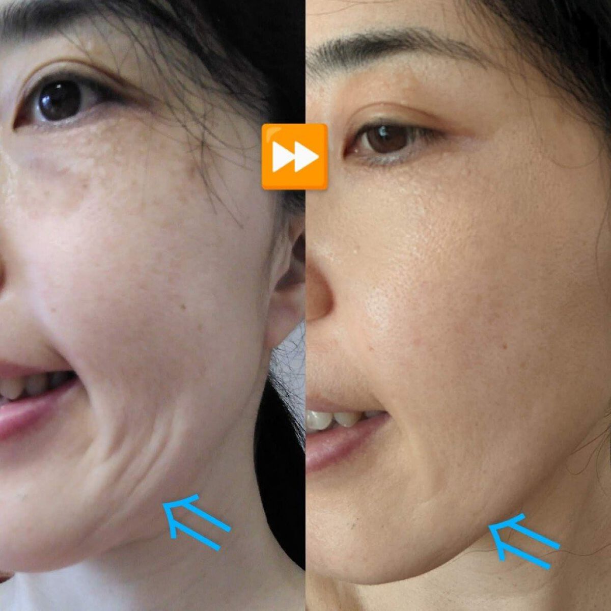 ピンク丸剤/ミオル韓医院/ボディサプリメントを使ったクチコミ(3枚目)