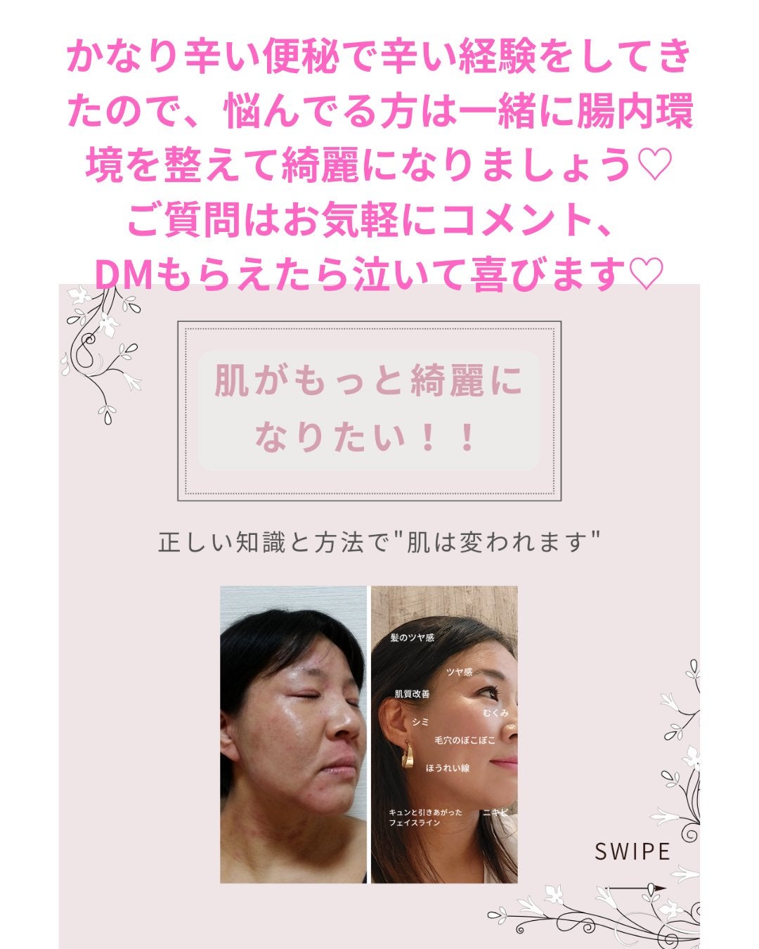美肌カウンセラー💆肌悩みを解決し見る世界を変える on LIPS 「肌を綺麗にする専門家💆美肌カウンセラーおすすめ\毛穴の悩みは改..」(5枚目)