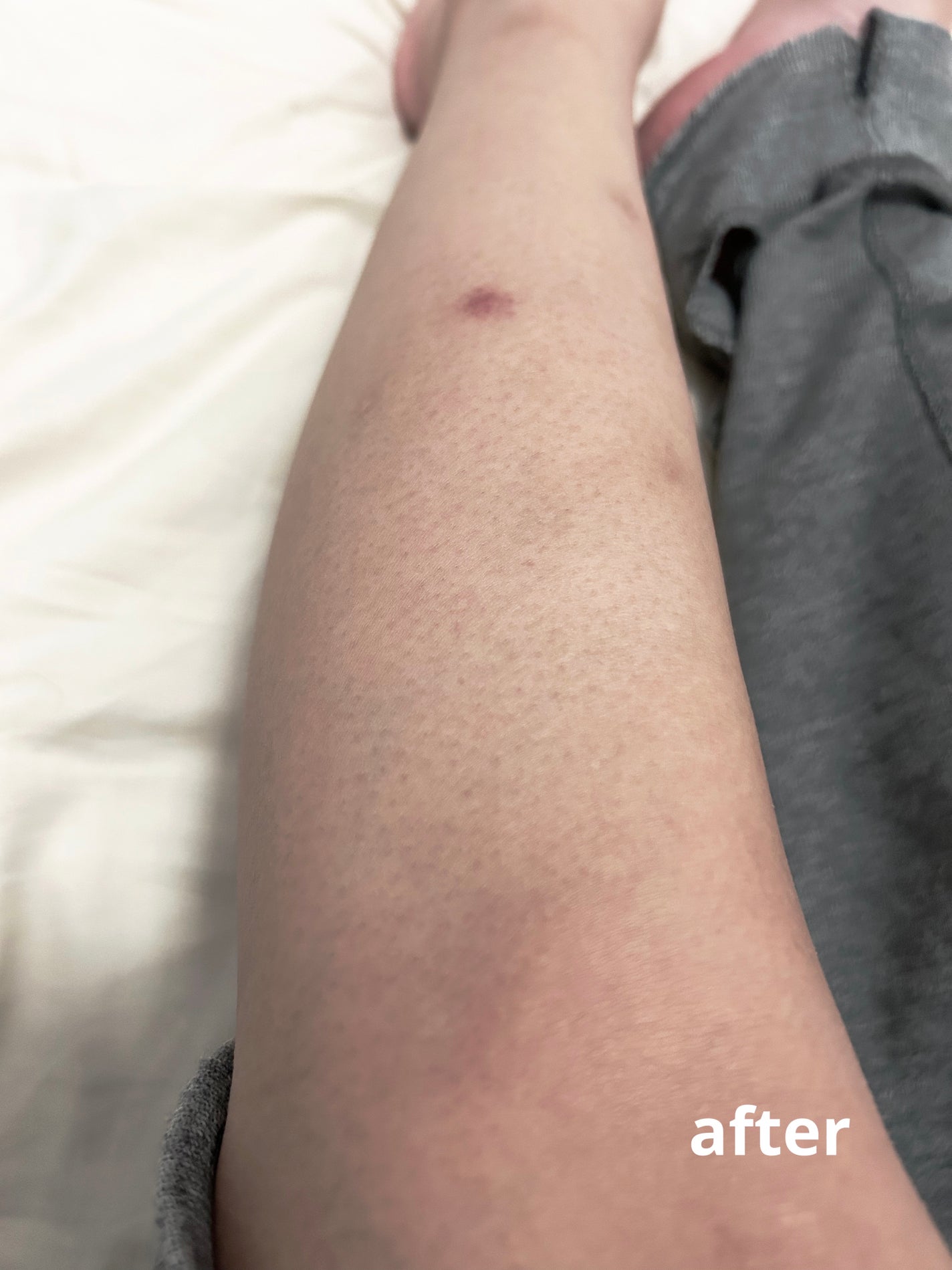 サロンプラス エンザイム ボディ シェービングエマルジョン/サロンプラス/ムダ毛ケアを使ったクチコミ(3枚目)