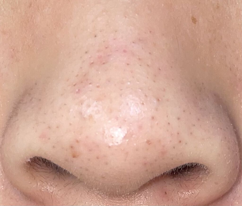 クレンジングバーム/ink./クレンジングバームを使ったクチコミ（1枚目）