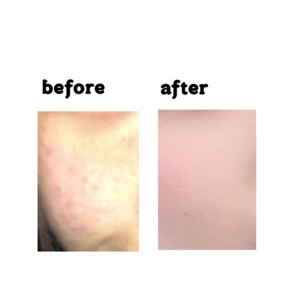 ハトムギ化粧水(ナチュリエ スキンコンディショナー R )/ナチュリエ/化粧水を使ったクチコミ(2枚目)