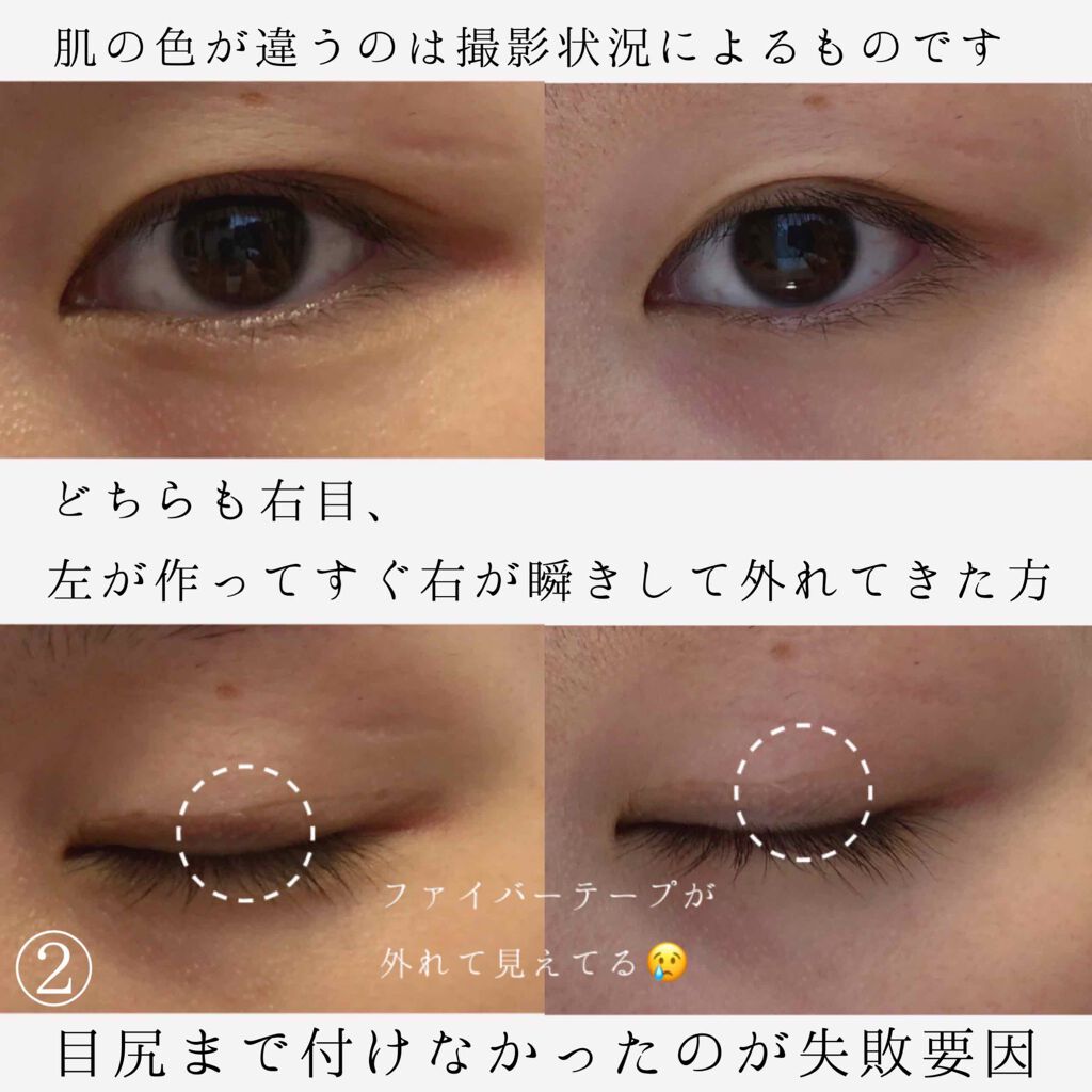 フリーファイバー120 スタンダードタイプ /メザイク/二重まぶた用アイテムを使ったクチコミ(6枚目)