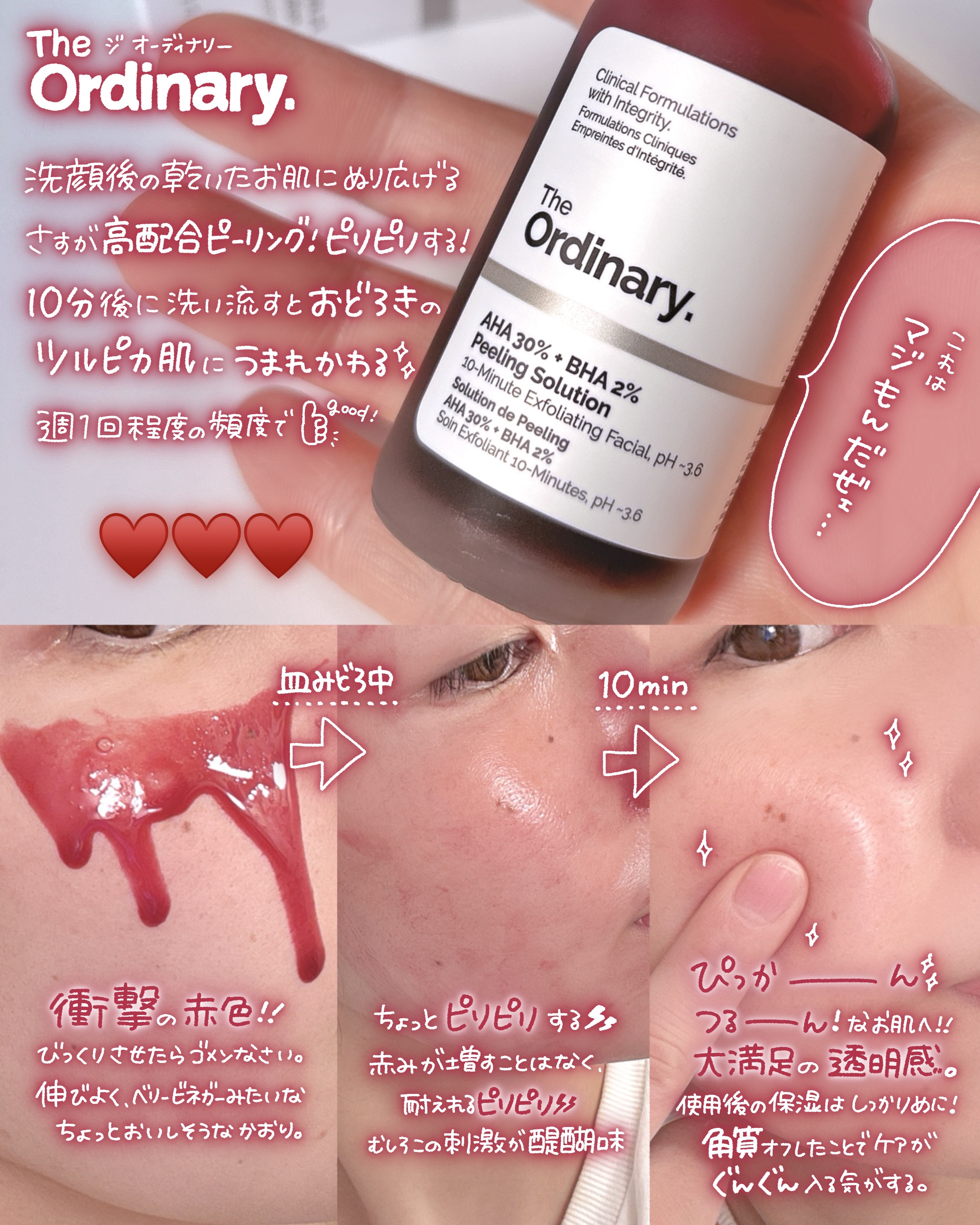 AHA 30% + BHA 2% Peeling Solution/The Ordinary/ピーリングを使ったクチコミ（3枚目）
