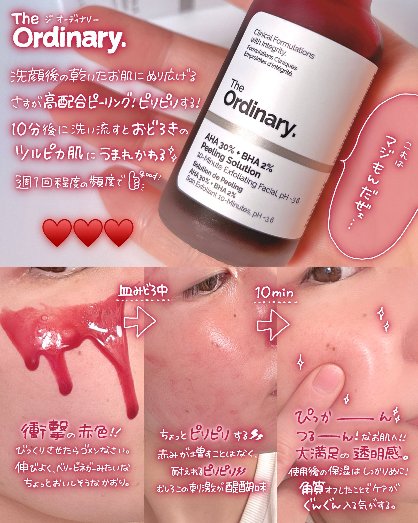 AHA 30% + BHA 2% Peeling Solution/The Ordinary/ピーリングを使ったクチコミ(3枚目)