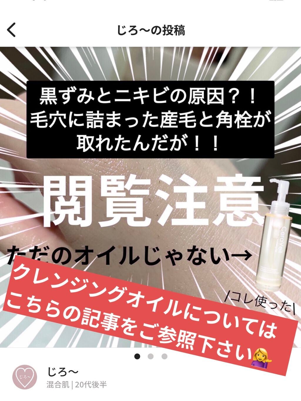 かき©︎ on LIPS 「《人生最悪のニキビに悩まされていたときに効果を感じた洗顔料&ク..」(4枚目)