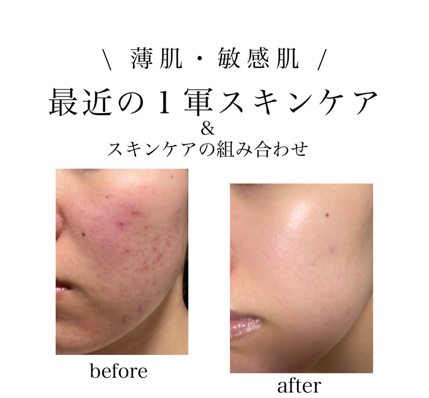 ザ・タイムR アクア/IPSA/化粧水を使ったクチコミ(1枚目)