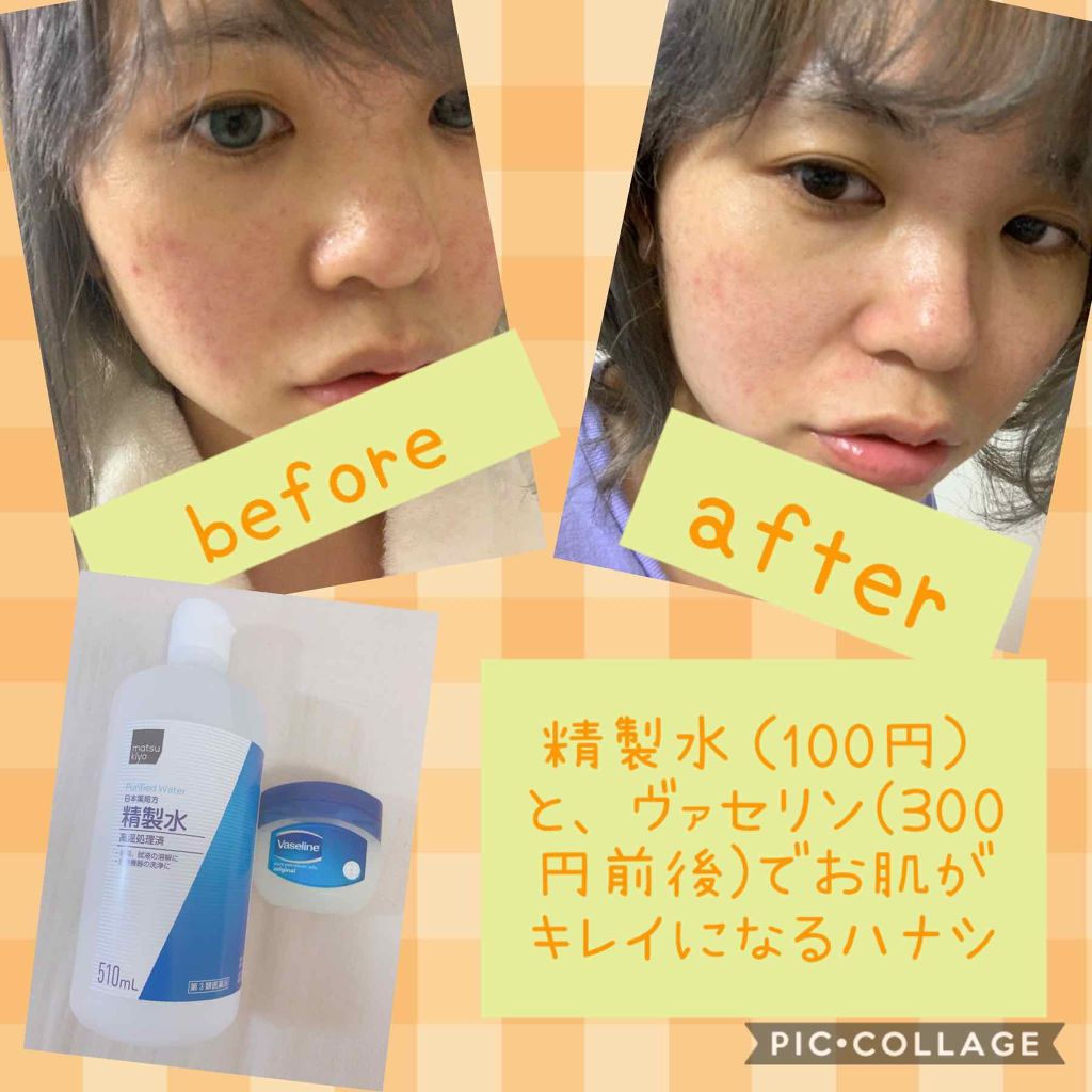 精製水(医薬品)/日本薬局方/その他を使ったクチコミ（1枚目）