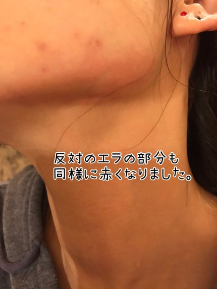 レチノールA 1% アドバンスドリバイタリゼーションクリーム/Life-flo/フェイスクリームを使ったクチコミ(4枚目)