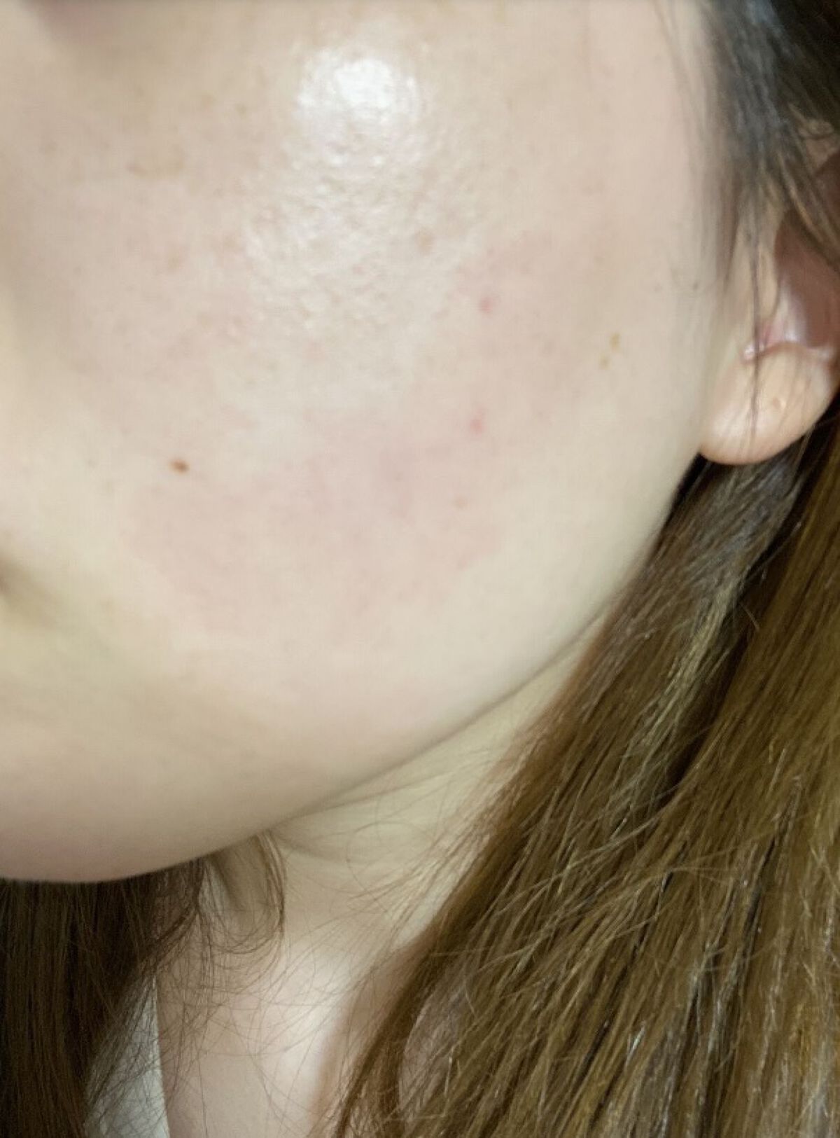 ナチュラボ 生ハーブピーリング/石澤研究所/ピーリングを使ったクチコミ（3枚目）