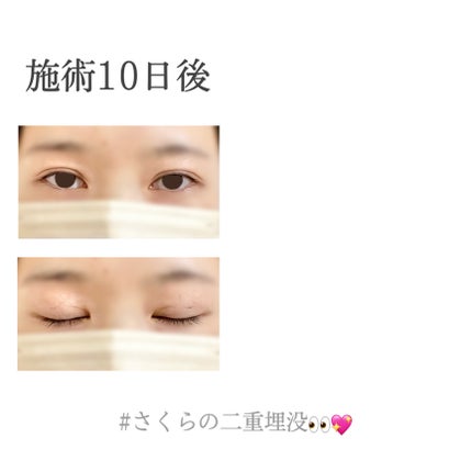 ãããðž on LIPS ãäºéåæ²¡äœéšèšâ¢ðð(æœè¡ç¿æ¥ã10æ¥åŸ)----------..ãïŒ8æç®ïŒ