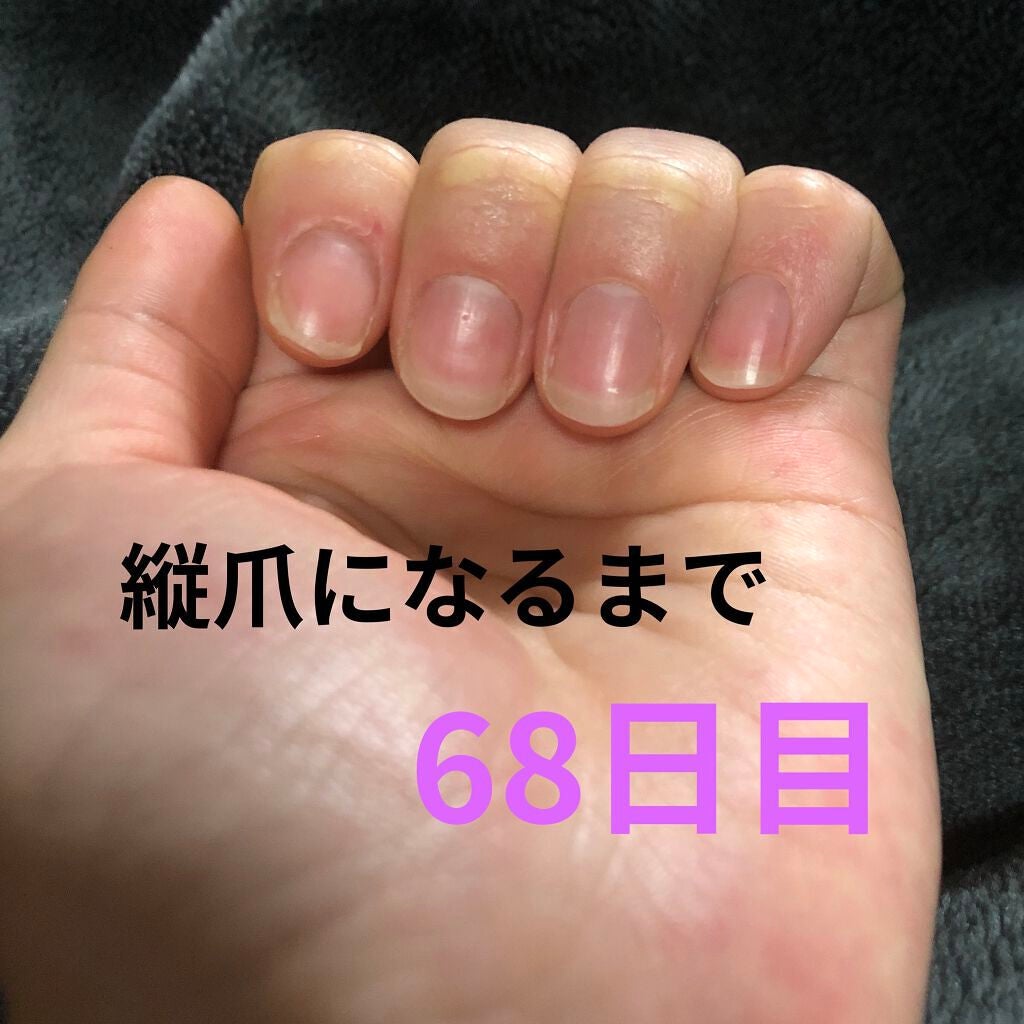 ð on LIPS ã瞊çªã«ãªãããã«ãããããªæ¹æ³ããã£ããæããŠãã ããð瞊çªã«..ãïŒ1æç®ïŒ