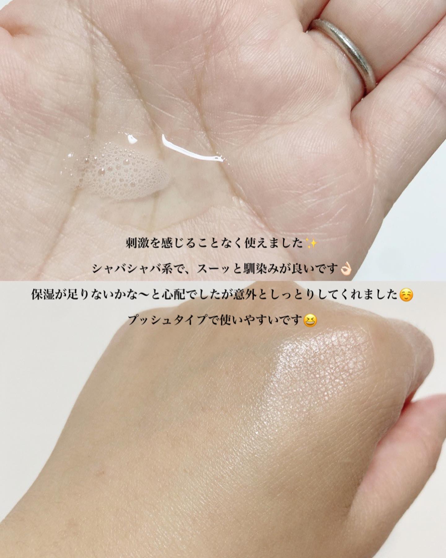 ミノン アミノモイスト 薬用アクネケア ミルク/ミノン/乳液を使ったクチコミ（3枚目）