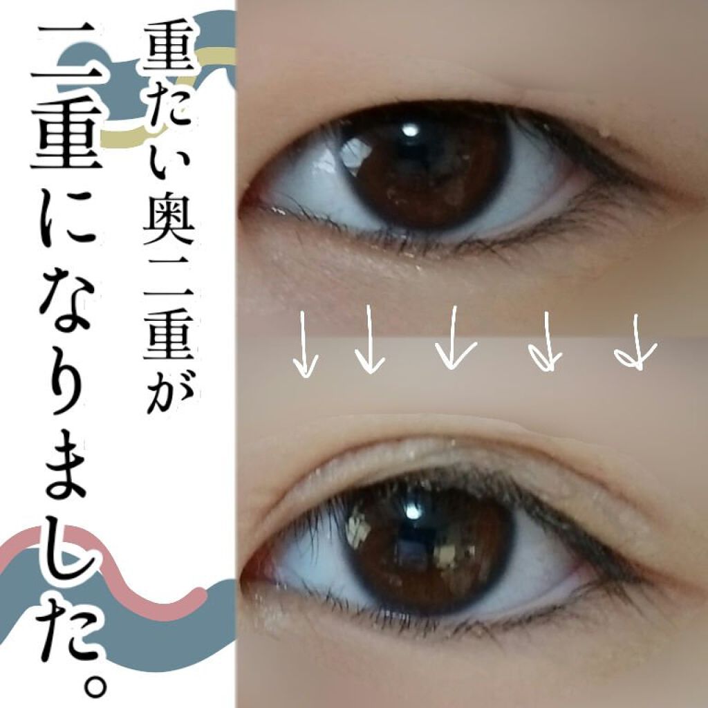 オリシキ アイリッドスキンフィルム /D-UP/二重まぶた用アイテムを使ったクチコミ(1枚目)
