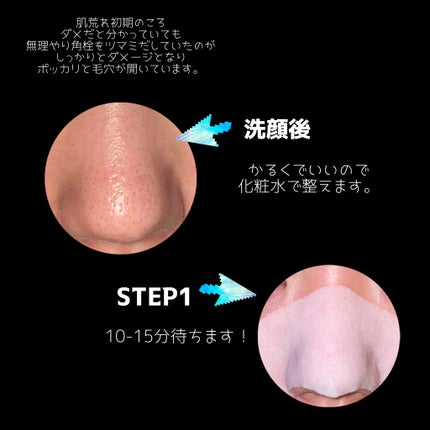 アンチポアブラックヘッドパーフェクトクリアキット/CNP Laboratory/シートマスク・パックを使ったクチコミ(2枚目)