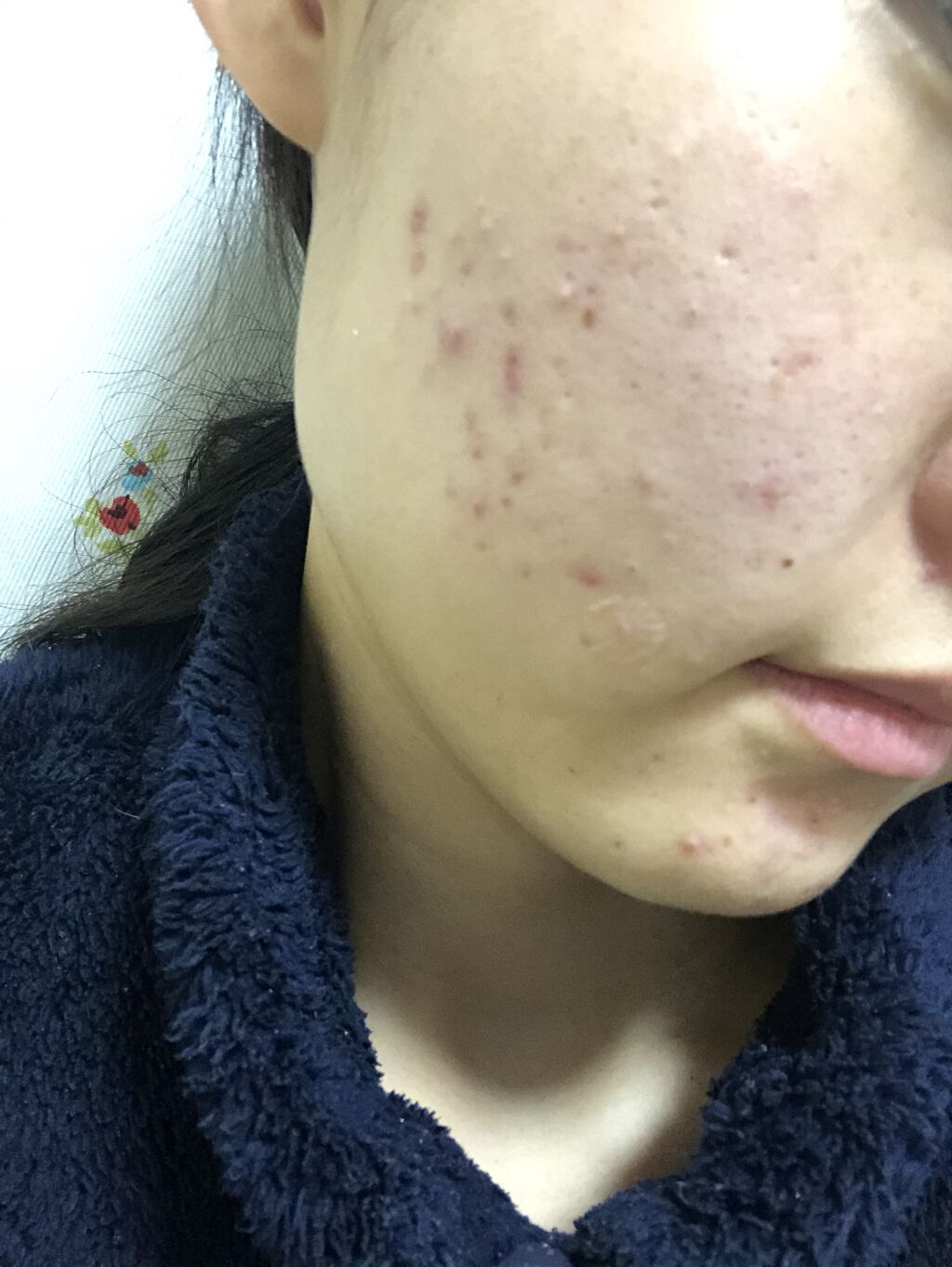 DHC ビタミンＣハードカプセル/DHC/美容サプリメントを使ったクチコミ（2枚目）