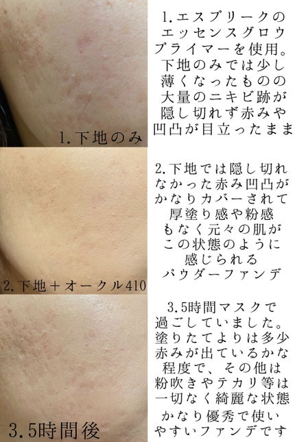 シンクロフィット パクト EX/ESPRIQUE/パウダーファンデーションを使ったクチコミ(4枚目)