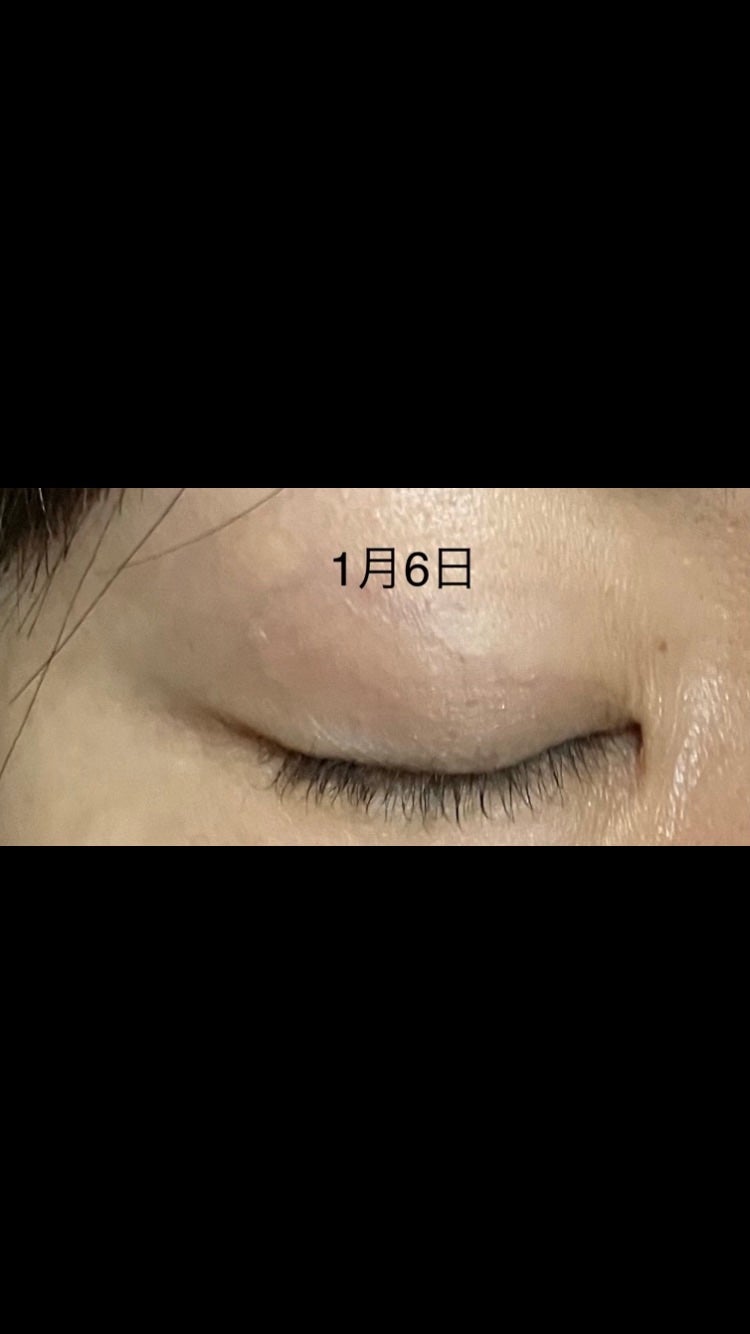 ラッシュアディクト アイラッシュコンディショニングセラム/soaddicted/まつげ美容液を使ったクチコミ(2枚目)