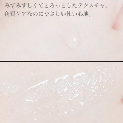 エファクラ ピールケア セラム/ラ ロッシュ ポゼ/美容液を使ったクチコミ(5枚目)