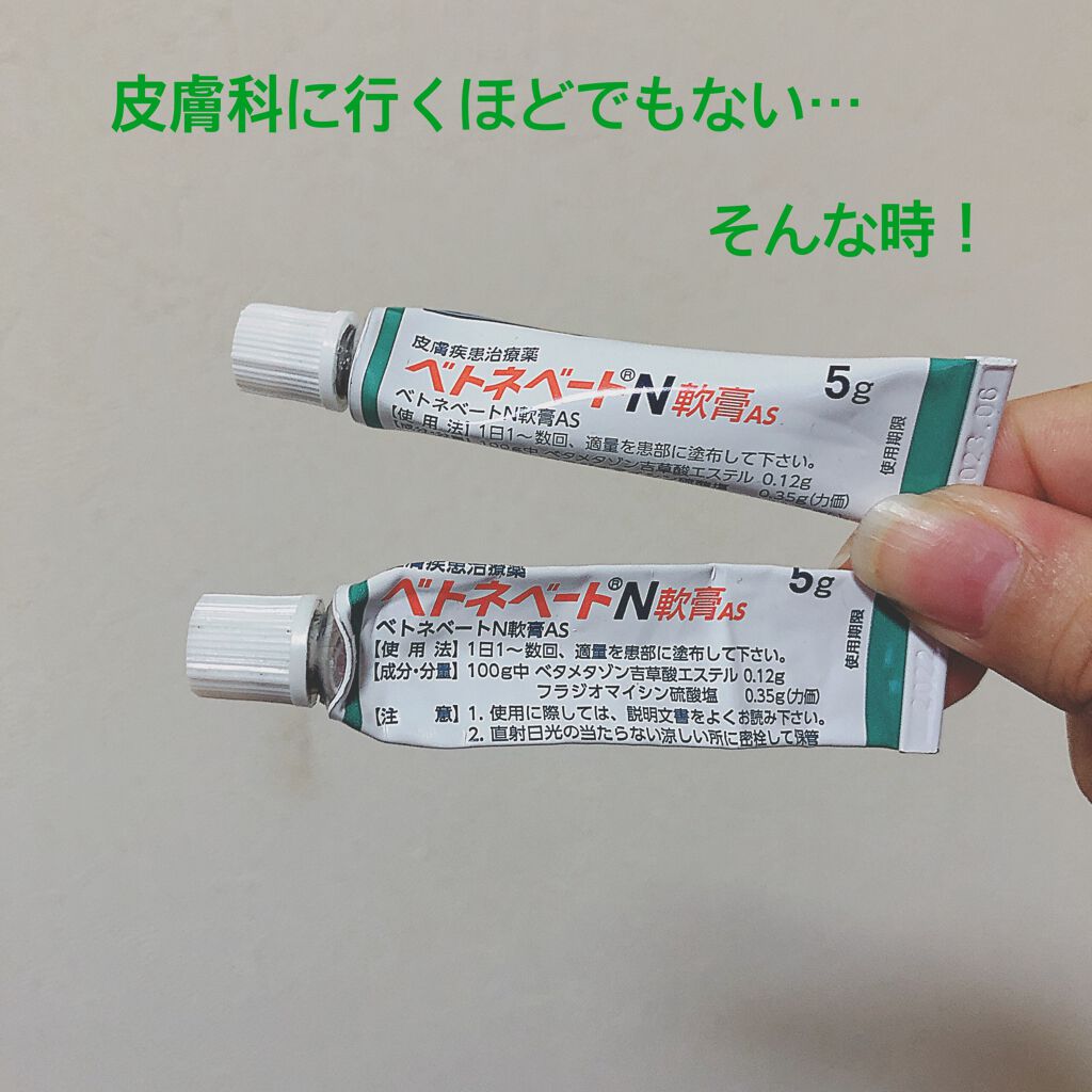 ベトネベートN軟膏AS(医薬品)/第一三共ヘルスケア/その他を使ったクチコミ（1枚目）