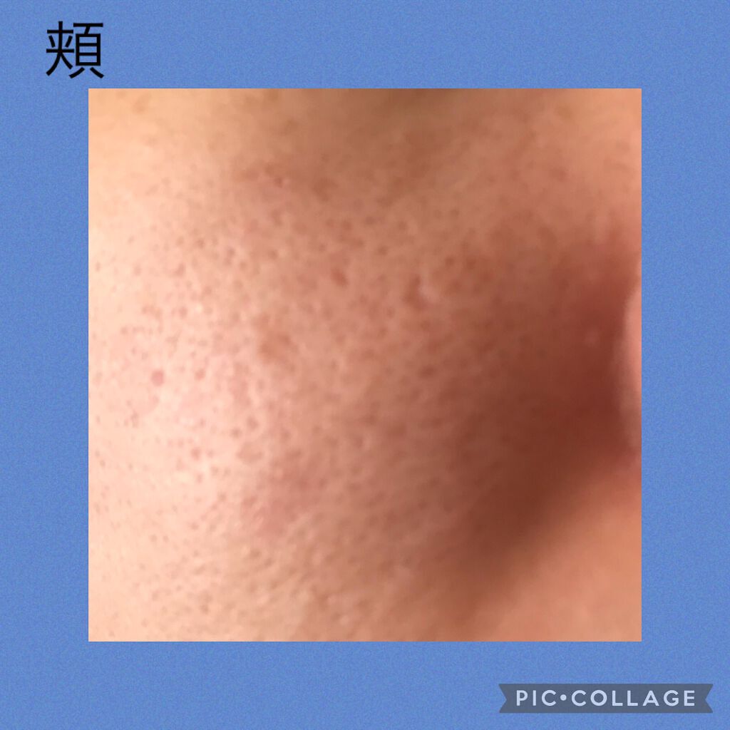 ハトムギ化粧水(ナチュリエ スキンコンディショナー R )/ナチュリエ/化粧水を使ったクチコミ（2枚目）