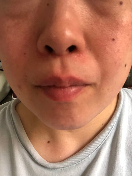 エニシーグローパック/enisie/シートマスク・パックを使ったクチコミ(8枚目)